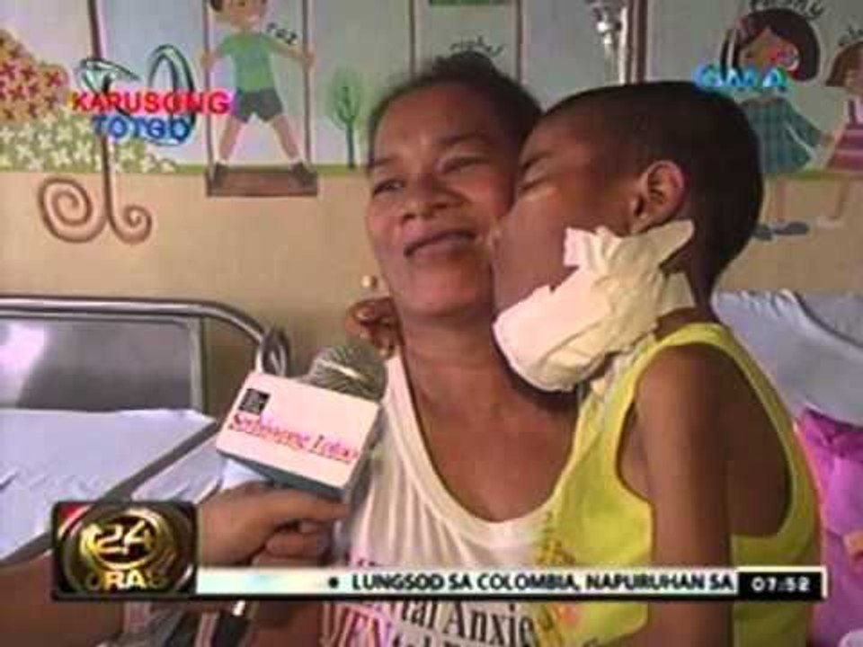 24 Oras:   Batang tinubuan ng malaking bukol sa pisngi, naoperahan na