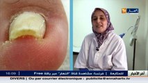 3 دقائق صحة   الالتهابات الفطرية للأظافر وعلاجها