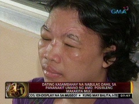 24 Oras: Dating kasambahay na nabulag dahil sa pananakit umano ng amo, posibleng makakita muli