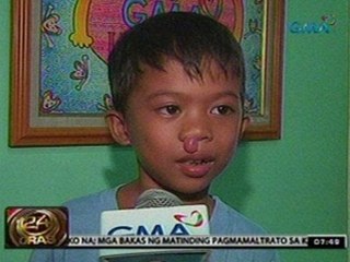 24 Oras: Batang lumuwa ang bukol sa ilong, muling nakapiling ang kanyang ina