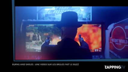 Burns and smiles : la vidéo choc sur les brûlés et le regard des autres