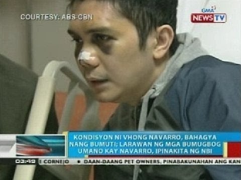 BP: Mga nasasangkot umano sa pambubugbog kay Navarro, hindi pa humaharap sa NBI