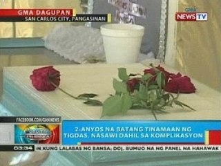 Bata sa San Carlos City, Pangasinan na tinamaan ng tigdas, nasawi dahil sa komplikasyon