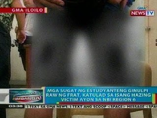 BP: Mga sugat ng estudyanteng ginulpi raw ng frat, parang sa hazing victim
