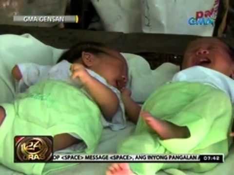 24 Oras: Sanggol, ipinanganak na putol ang mga paa, iisa ang kamay at dikit-dikit ang mga daliri