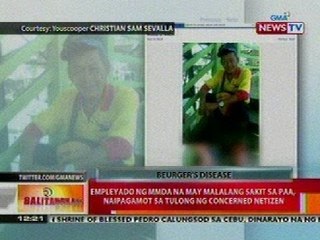 BT: Empleyado ng MMDA na may malalang sakit sa paa, naipagamot sa tulong ng concerned netizen