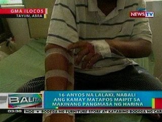 BP: 16-anyos na lalaki, nabali ang kamay matapos maipit sa makinang pangmasa ng harina