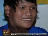 24 Oras: Binatilyong may cancer sa lalamunan, hinatiran ng Pamasko ng Kapuso Reporters