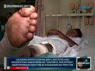 Saksi: Mga biktima ng paputok at ligaw na bala simula Dec. 21, nasa 72 na