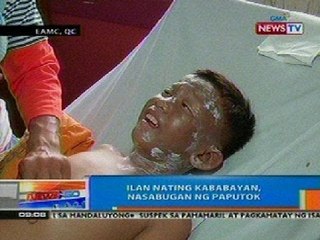 NTG: Ilan nating kababayan, nasabugan ng paputok