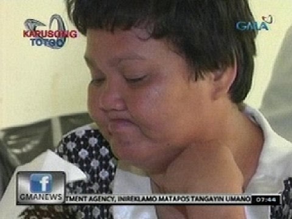 24 Oras: 97, mabibigyan ng bagong pustiso sa "Ngiting Kapuso Project" ng Kapuso Foundation