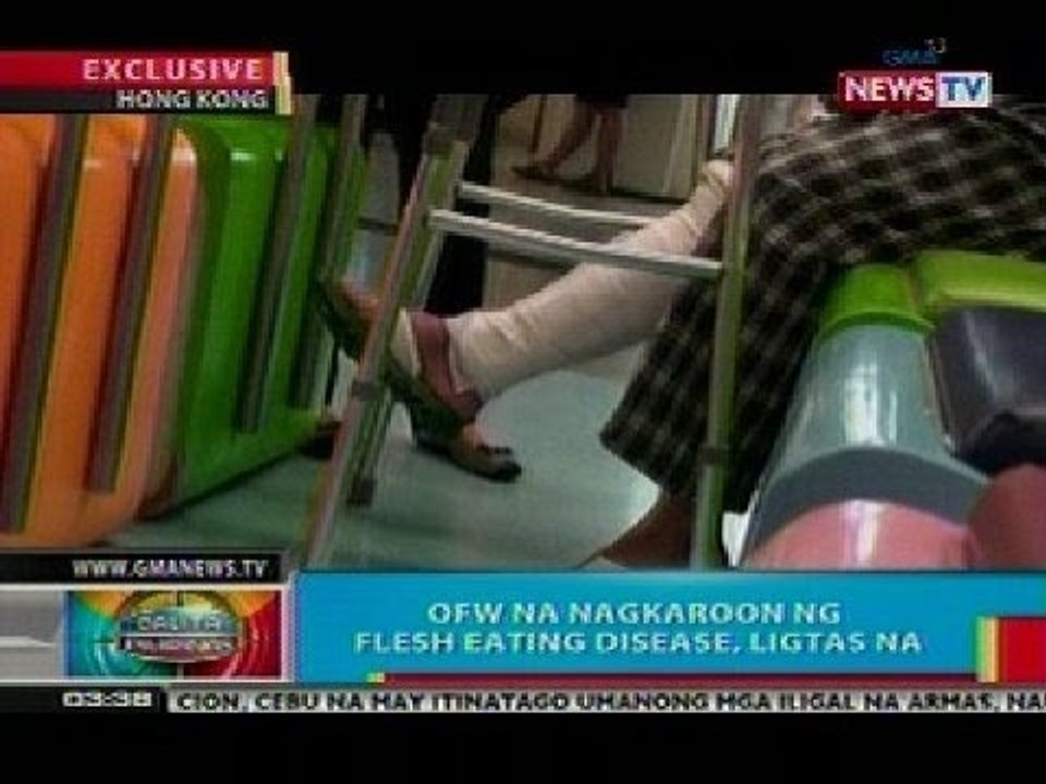 BP: OFW na nagkaroon ng flesh eating disease, ligtas na