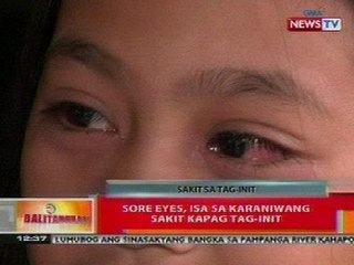 BT: Sore eyes, isa sa karaniwang sakit kapag tag-init