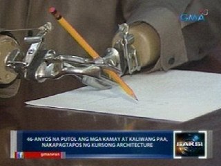 Saksi: 46-anyos na putol ang mga kamay at kaliwang paa, nakapagtapos ng kursong architecture