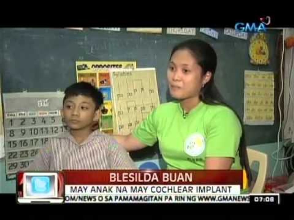 Ilang Pinoy na may problema sa pandinig, 'di sang-ayon sa pagpapakabit ng cochlear implant