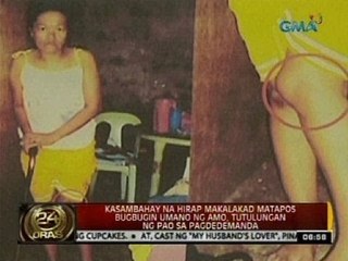 Kasambahay na hirap makalakad matapos bugbugin umano ng amo, tutulungan ng pao sa pagdedemanda