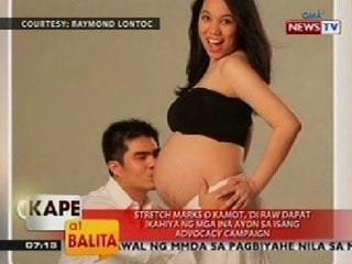 KB: Stretch marks o kamot, 'di raw dapat ikahiya ng mga ina ayon sa isang advocacy campaign