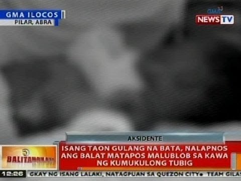BT: Bata sa Pilar, Abra, nalapnos ang balat matapos malublob sa kawa ng kumukulong tubig