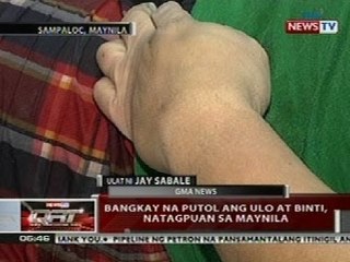 QRT: Bangkay na putol ang ulo at binti, natagpuan sa Maynila