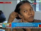 BP: Tenga ng isang babae, napunit matapos kagatin ng nakaaway na brgy. kagawad sa Iloilo City