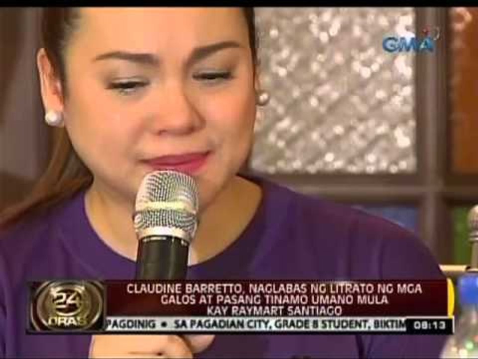 Claudine Barretto, naglabas ng litrato ng mga galos at pasang tinamo umano mula kay Raymart Santiago