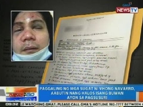 NTG: Paggaling ng mga sugat ni Vhong Navarro, aabutin nang halos 1 buwan