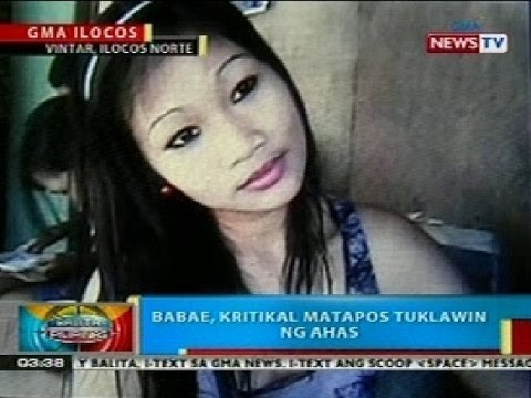 BP: Babae sa Ilocos Norte, kritikal nang tuklawin ng ahas