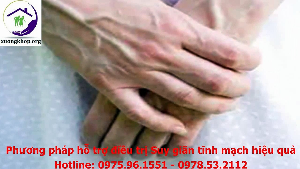 Chân nổi gân xanh là dấu hiệu cảnh báo bệnh suy giãn tĩnh mạch chân nguy hiểm