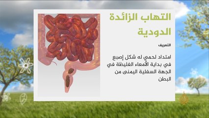 هذا الصباح-فائدة الزائدة الدودية في الجسم البشري