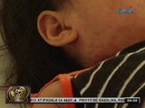 Kawalan ng tamang impormasyon sa pagbabakuna, isa sa mga dahilan ng pagkalat ng tigdas