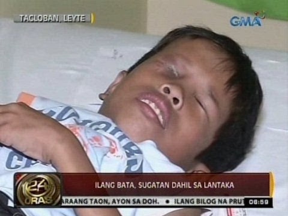 24 Oras: Ilang bata sa Tacloban, sugatan dahil sa lantaka