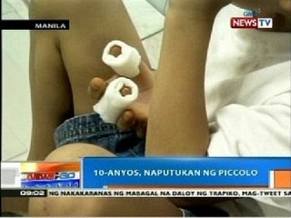 NTG: 10-anyos, naputukan ng piccolo