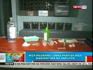 BP: Mga paunang lunas para sa mga mabibiktima ng paputok
