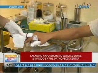 UB: Lalaking naputukan ng whistle bomb, isinugod sa Phl Orthopedic Center