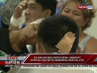 SONA: Bilang ng mga naputukan sa Jose Reyes Hospital sa Maynila, tumaas