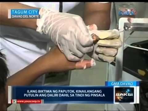 Saksi: Mga naputukan ngayong taon, mas marami kumpara noong nakaraang taon