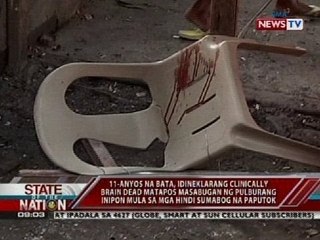 11 yo na  bata, clinically brain dead matapos masabugan ng pulburang inipon mula sa mga paputok