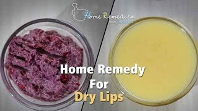 Home Remedy For Dry Lips | How To Get Rid Of Dry Lips Instantly | Home Remedies With Upasana
