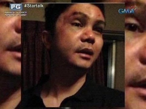 Startalk Exclusive: Vhong Navarro, inaakusahan nga ba ng attempted rape?