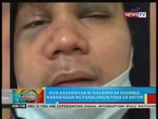 BP: Mga kasamahan ni Navarro sa showbiz, nanawagan ng panalangin para sa aktor