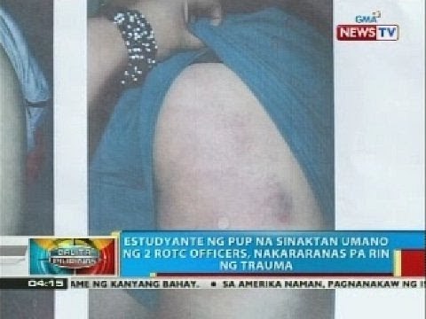 BP: Estudyante ng PUP na sinaktan umano ng 2 ROTC officers, nakararanas pa rin ng trauma