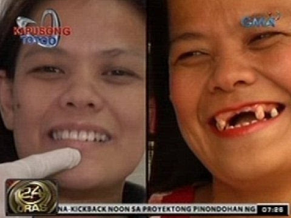 24 Oras: Mga nahandugan ng bagong pustiso ng "Ngiting Kapuso" Project