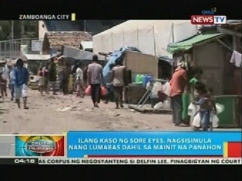 BP: DOH, nagpaalala sa publiko na mag-ingat laban sa mga karaniwang sakit tuwing tag-init