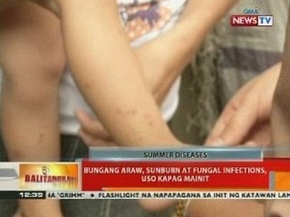BT: Bungang araw, sunburn at fungal infections uso kapag mainit