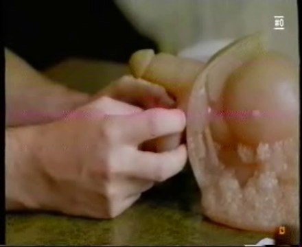 Examen andrologico: Testiculos y pene