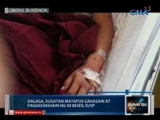 Saksi: Dalaga sa Bukidnon, sugatan matapos gahasain at 50 beses na sinaksak