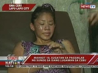SONA: Mahigit 10, sugatan sa pagsiklab ng sunog sa isang lugawan sa Cebu