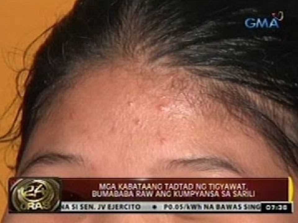 24 Oras: Teenagers, Mas madalas daw tini-tigyawat tuwing tag-init