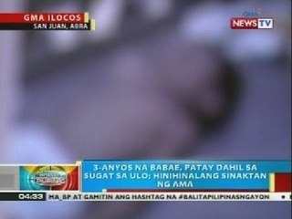 3-anyos na babae, patay dahil sa sugat sa ulo; hinihinalang sinaktan ng ama