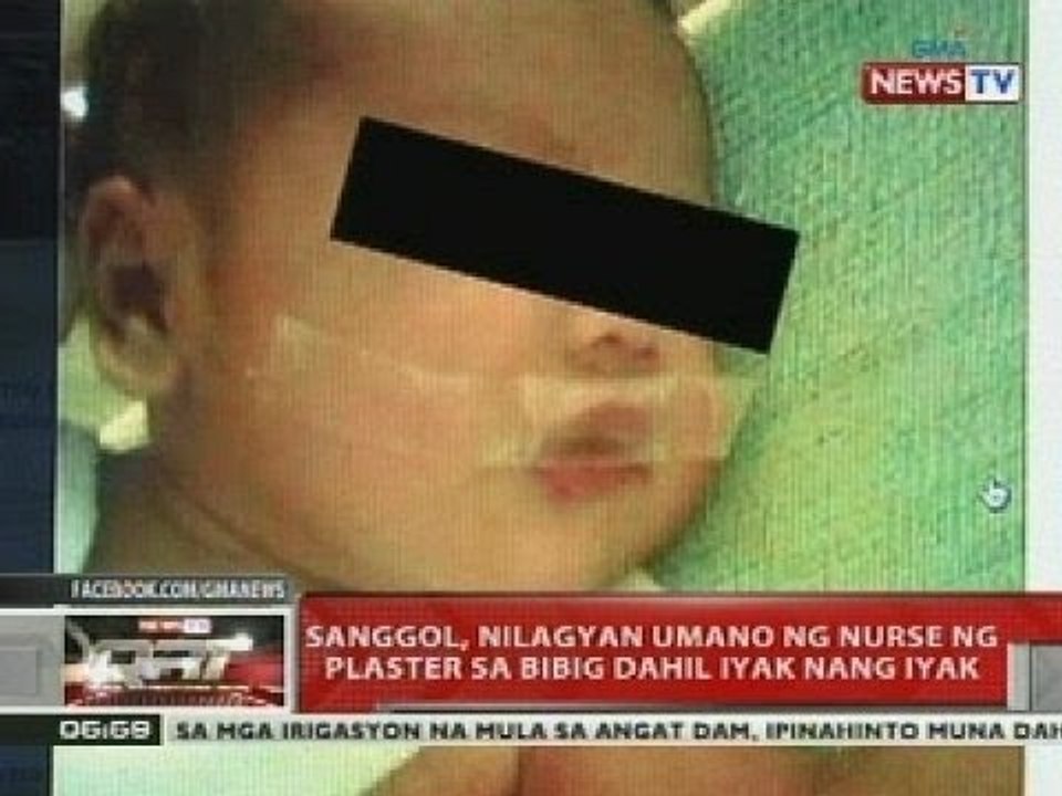 QRT: Sanggol, nilagyan umano ng nurse ng plaster sa bibig dahil iyak ng iyak